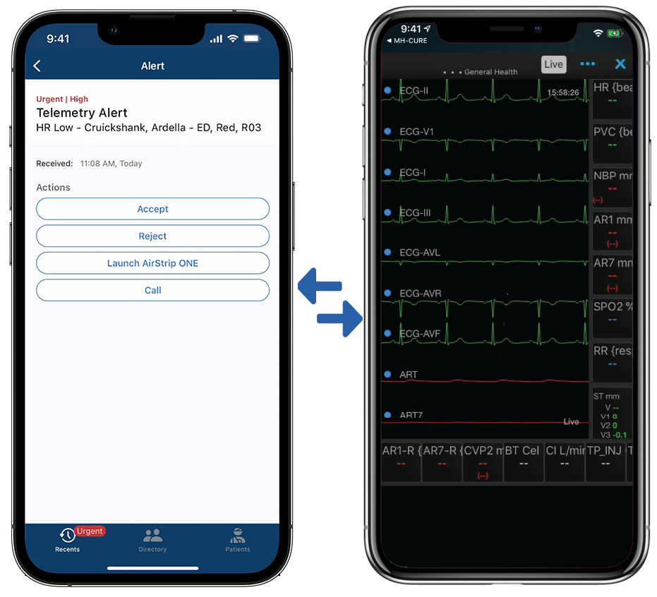 Patient wave form on mobile device